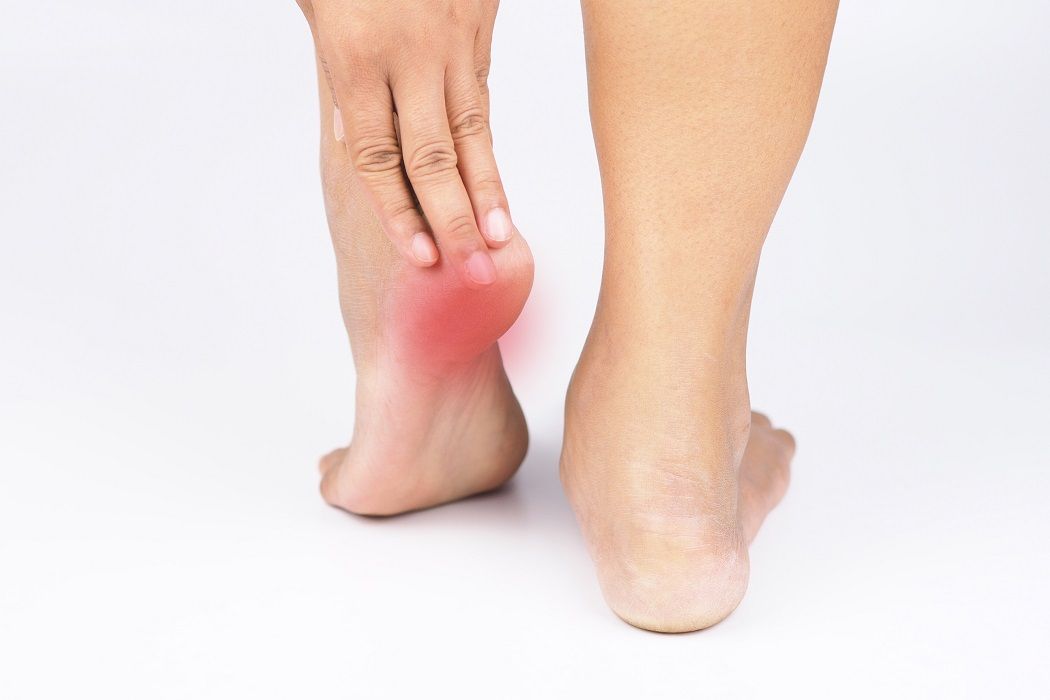heel pain symptoms
